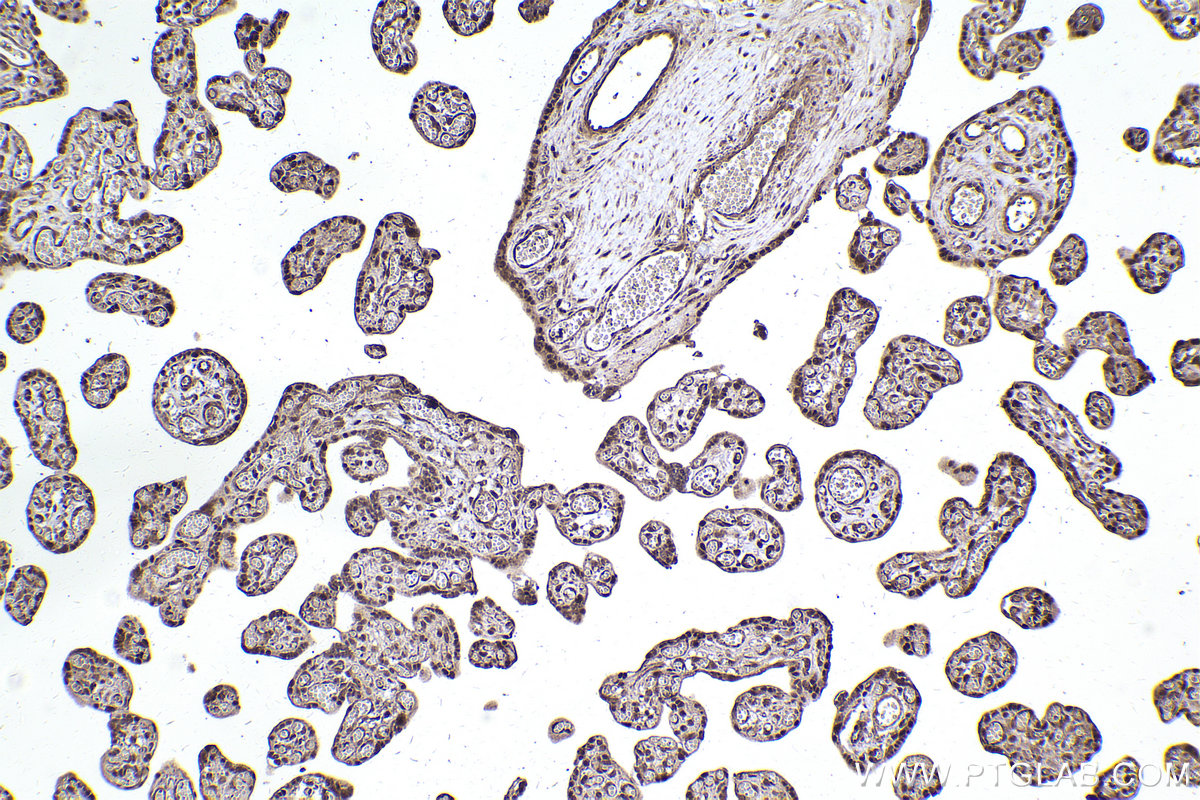 Immunohistochemical analysis of paraffin-embedded human placenta tissue slide using KHC2475 (PSMD6 IHC Kit).