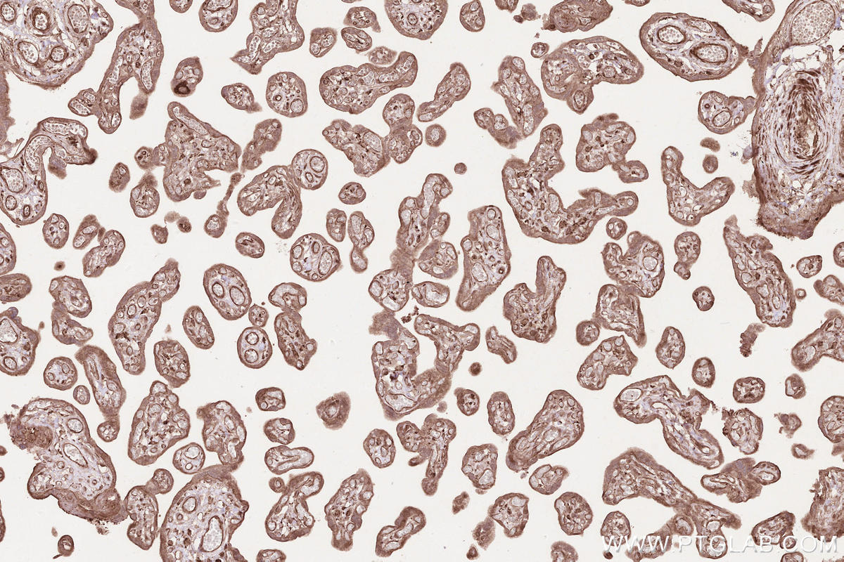 Immunohistochemical analysis of paraffin-embedded human placenta tissue slide using KHC2589 (PSRC1 IHC Kit).