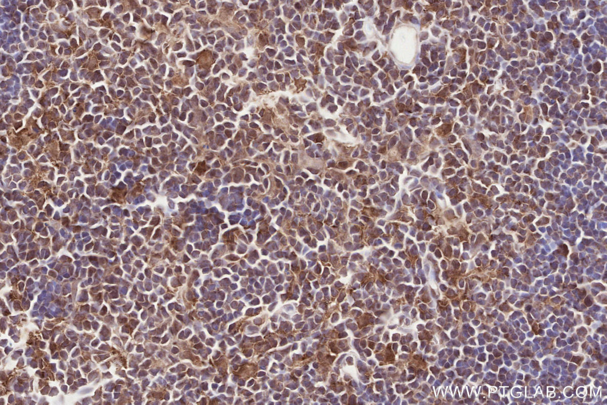 Immunohistochemical analysis of paraffin-embedded rat thymus tissue slide using KHC2589 (PSRC1 IHC Kit).