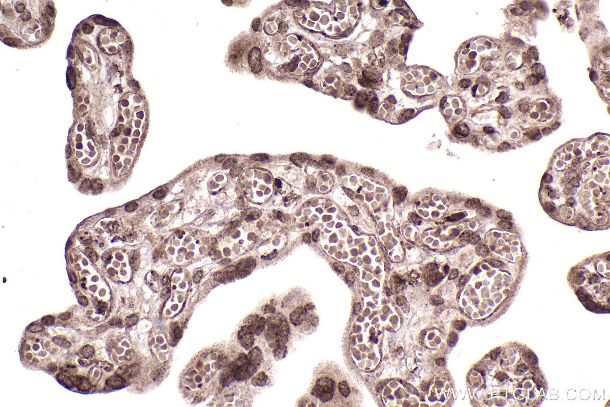 Immunohistochemical analysis of paraffin-embedded human placenta tissue slide using KHC2457 (PTK2B IHC Kit).