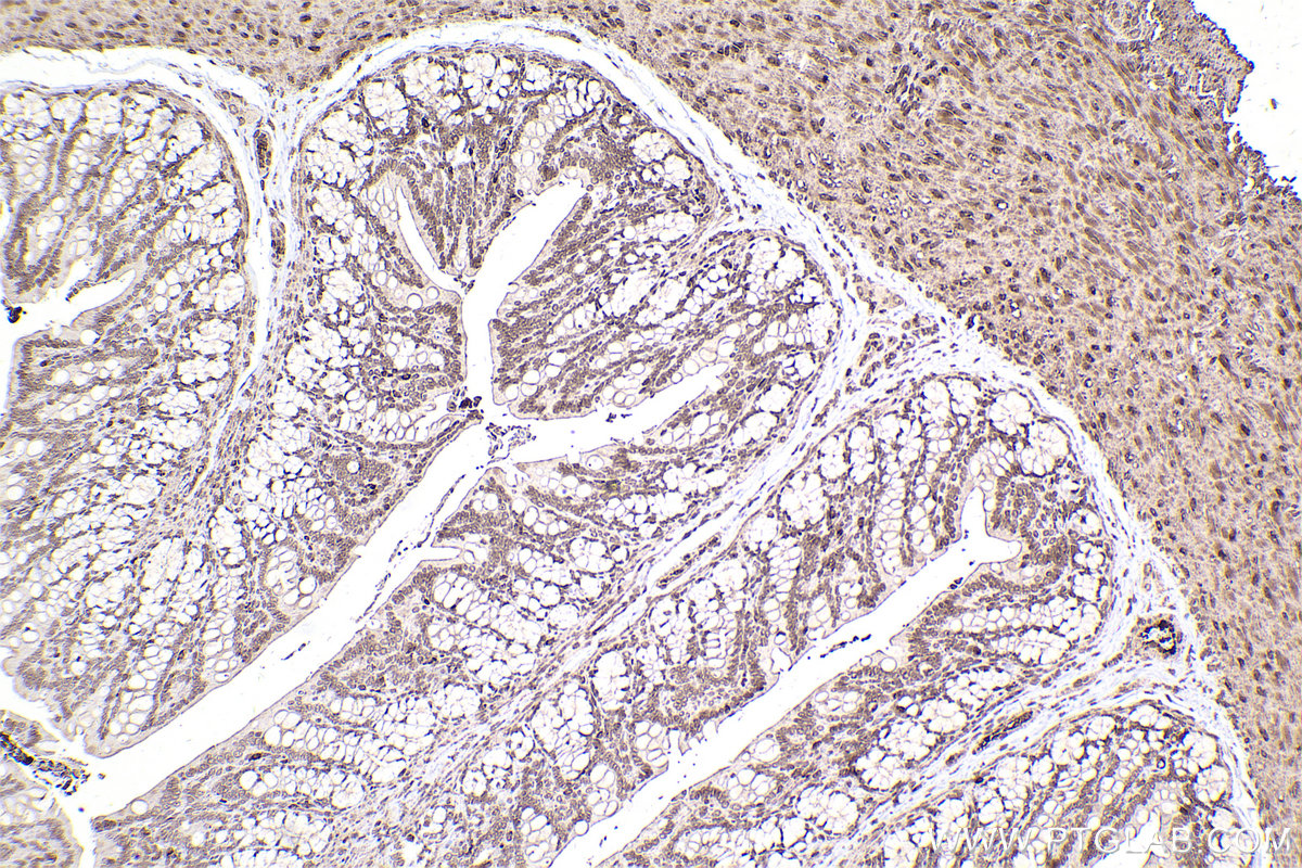 Immunohistochemical analysis of paraffin-embedded rat colon tissue slide using KHC2457 (PTK2B IHC Kit).