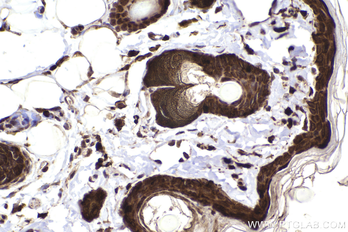 Immunohistochemical analysis of paraffin-embedded rat skin tissue slide using KHC2221 (PTPN6 IHC Kit).