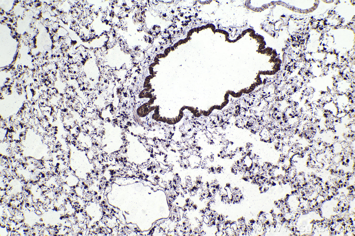 Immunohistochemical analysis of paraffin-embedded rat lung tissue slide using KHC2221 (PTPN6 IHC Kit).