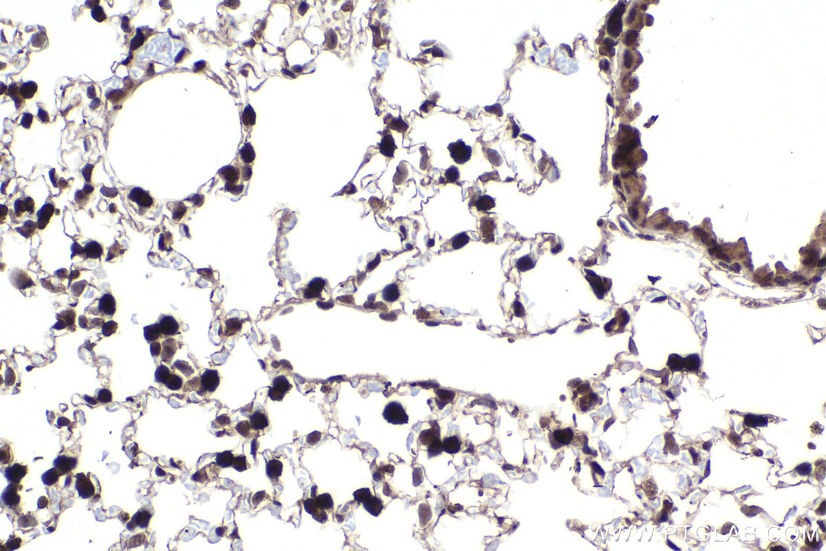 Immunohistochemical analysis of paraffin-embedded mouse lung tissue slide using KHC2221 (PTPN6 IHC Kit).