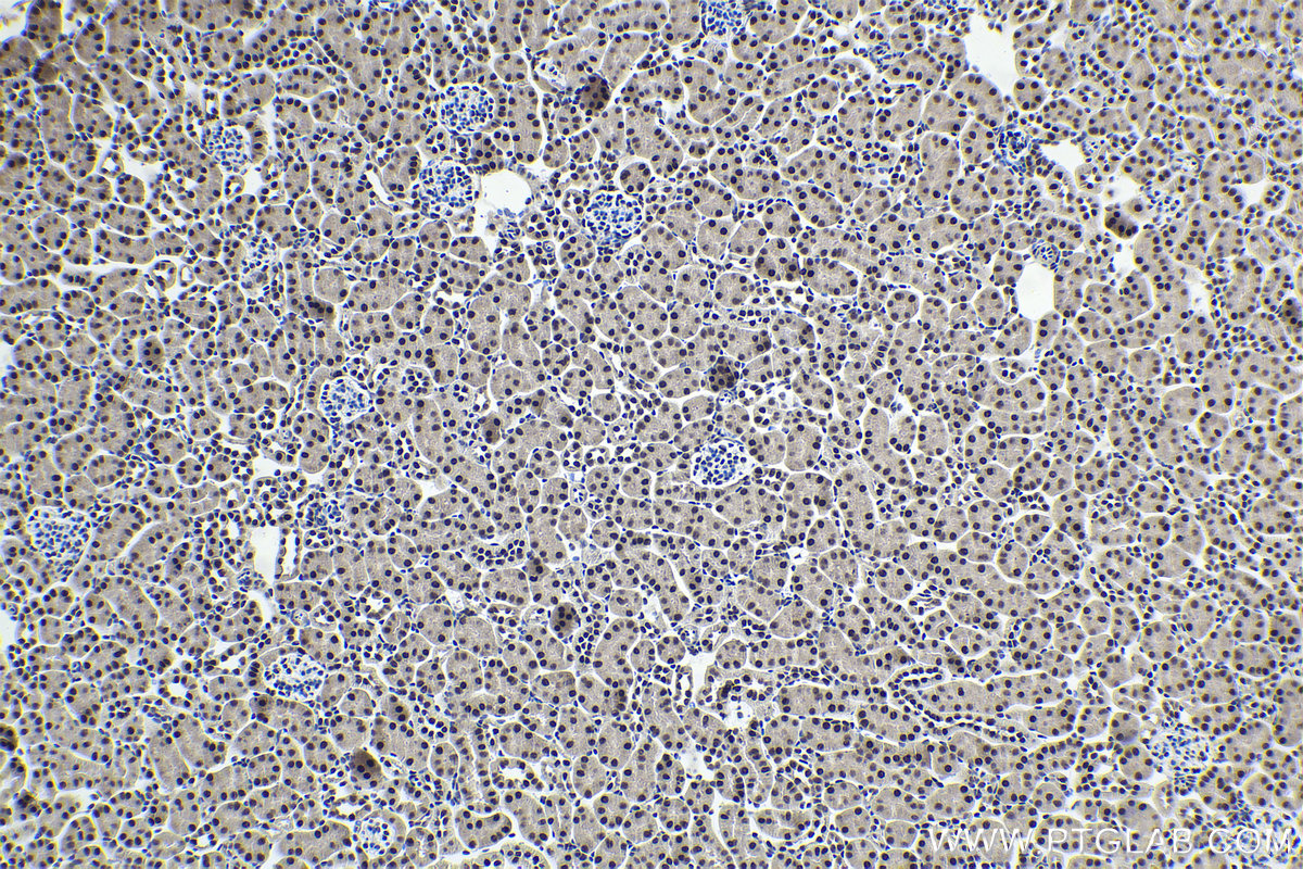 Immunohistochemical analysis of paraffin-embedded mouse kidney tissue slide using KHC1985 (PUF60 IHC Kit).