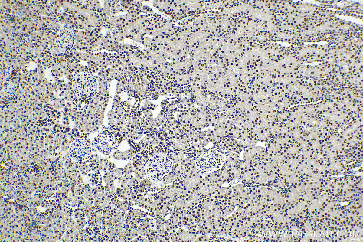 Immunohistochemical analysis of paraffin-embedded rat kidney tissue slide using KHC1985 (PUF60 IHC Kit).