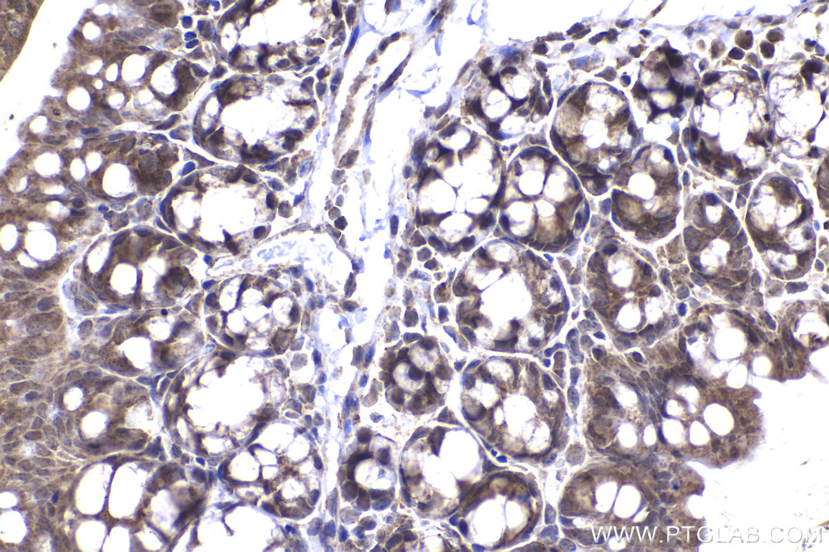 Immunohistochemical analysis of paraffin-embedded mouse small intestine tissue slide using KHC2244 (Prohibitin/PHB1 IHC Kit).