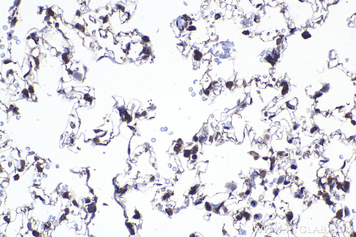 Immunohistochemical analysis of paraffin-embedded rat lung tissue slide using KHC2244 (Prohibitin/PHB1 IHC Kit).