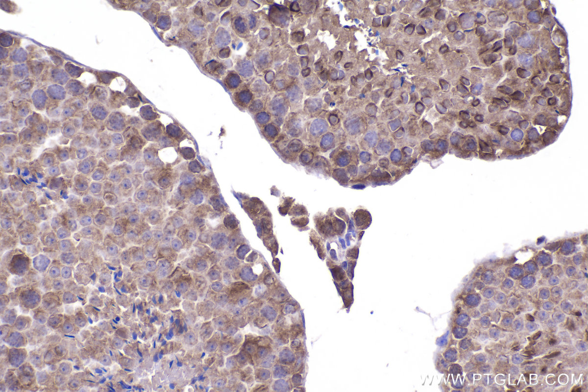 Immunohistochemical analysis of paraffin-embedded mouse testis tissue slide using KHC2337 (RAB10 IHC Kit).