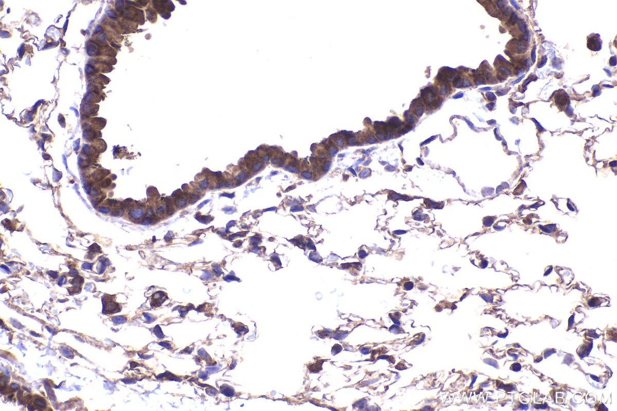 Immunohistochemical analysis of paraffin-embedded mouse lung tissue slide using KHC2337 (RAB10 IHC Kit).