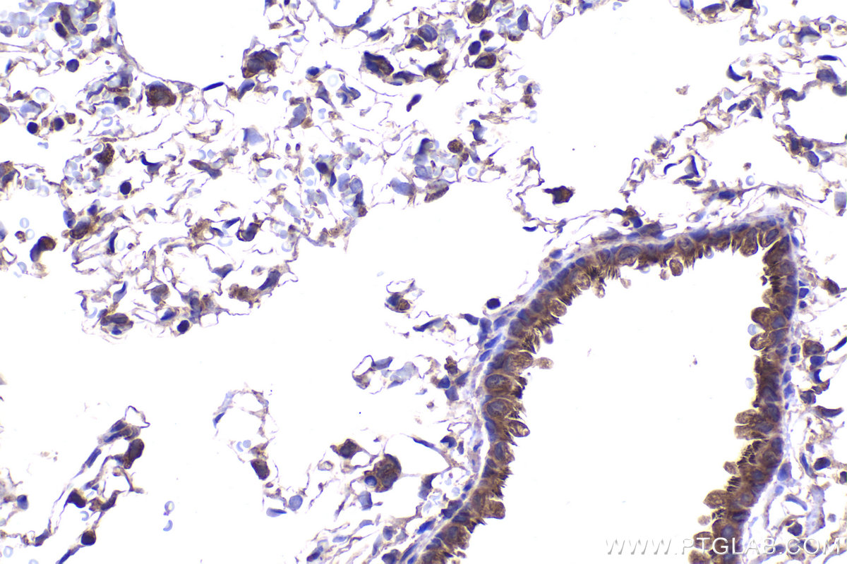 Immunohistochemical analysis of paraffin-embedded rat lung tissue slide using KHC2337 (RAB10 IHC Kit).