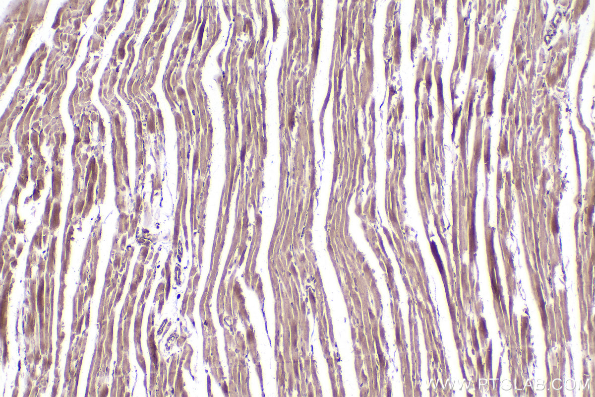 Immunohistochemical analysis of paraffin-embedded rat heart tissue slide using KHC2501 (RAB11B IHC Kit).