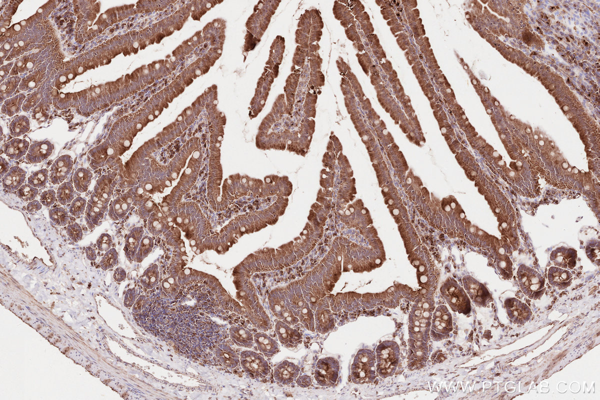 Immunohistochemical analysis of paraffin-embedded rat small intestine tissue slide using KHC2599 (RAB11FIP1 IHC Kit).