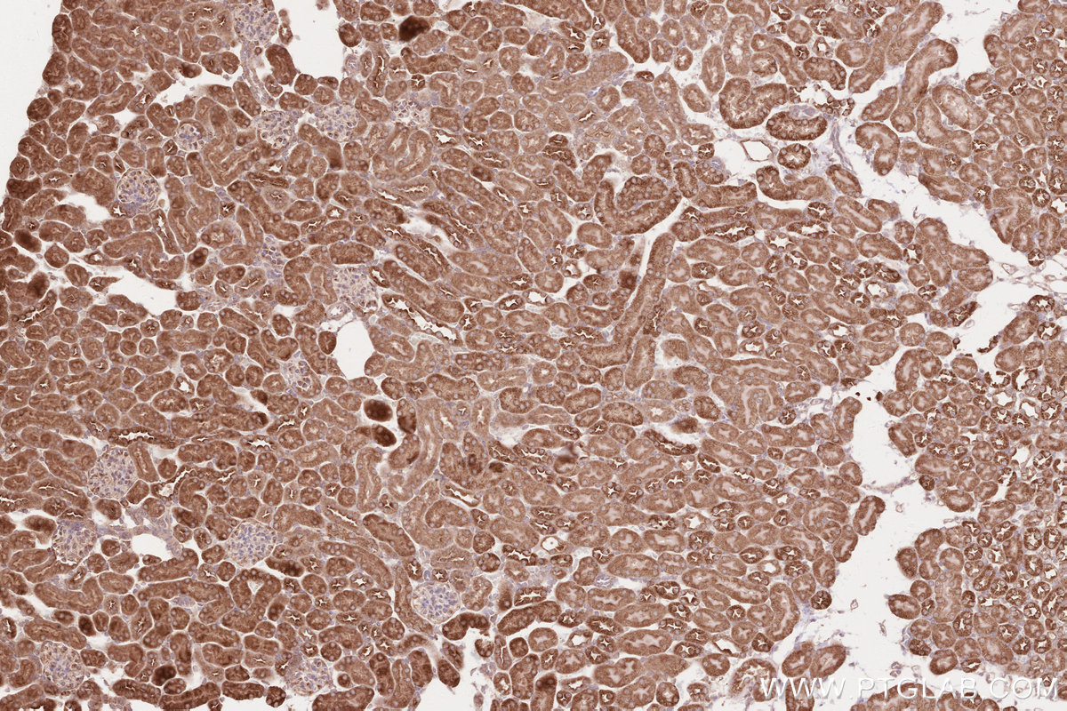 Immunohistochemical analysis of paraffin-embedded mouse kidney tissue slide using KHC2599 (RAB11FIP1 IHC Kit).