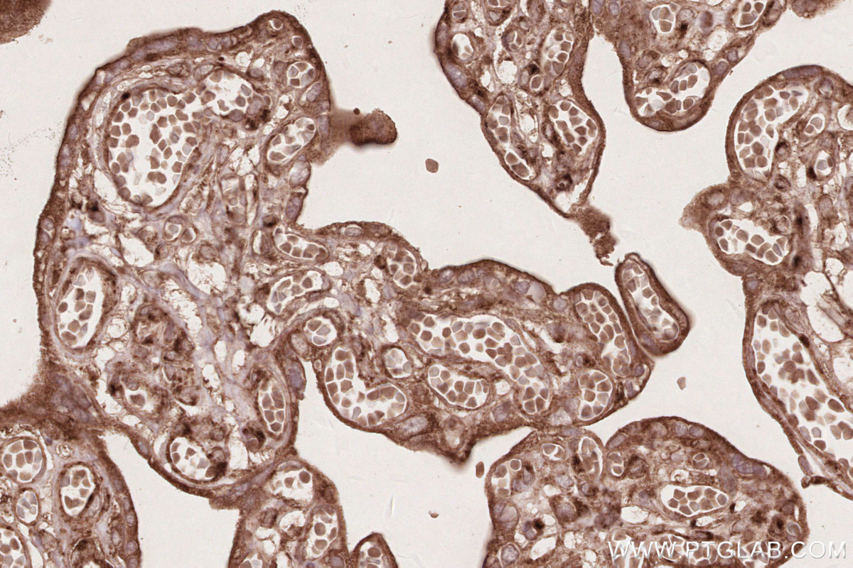 Immunohistochemical analysis of paraffin-embedded human placenta tissue slide using KHC2599 (RAB11FIP1 IHC Kit).