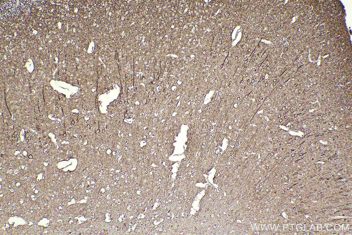 Immunohistochemical analysis of paraffin-embedded mouse brain tissue slide using KHC2302 (RAB13 IHC Kit).