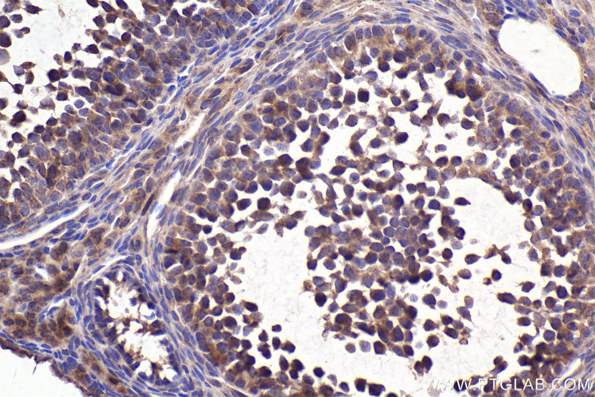 Immunohistochemical analysis of paraffin-embedded mouse ovary tissue slide using KHC2519 (RAB30 IHC Kit).