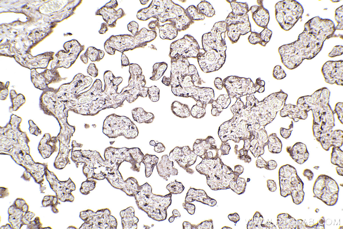 Immunohistochemical analysis of paraffin-embedded human placenta tissue slide using KHC2440 (RAB31 IHC Kit).