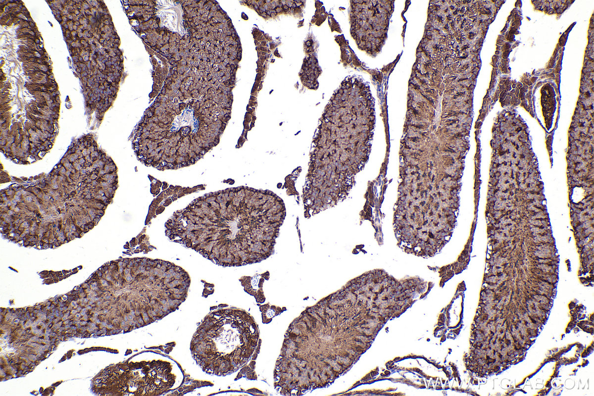 Immunohistochemical analysis of paraffin-embedded mouse testis tissue slide using KHC2440 (RAB31 IHC Kit).