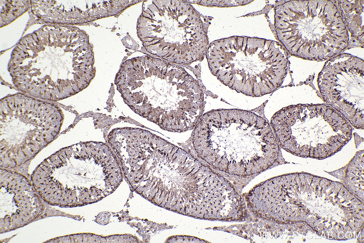 Immunohistochemical analysis of paraffin-embedded rat testis tissue slide using KHC2440 (RAB31 IHC Kit).