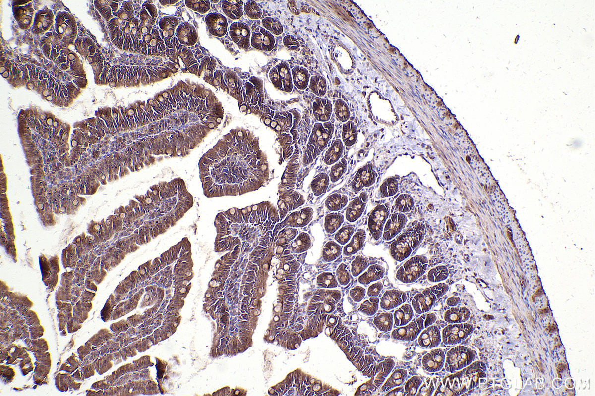 Immunohistochemical analysis of paraffin-embedded rat small intestine tissue slide using KHC2484 (RAB35 IHC Kit).