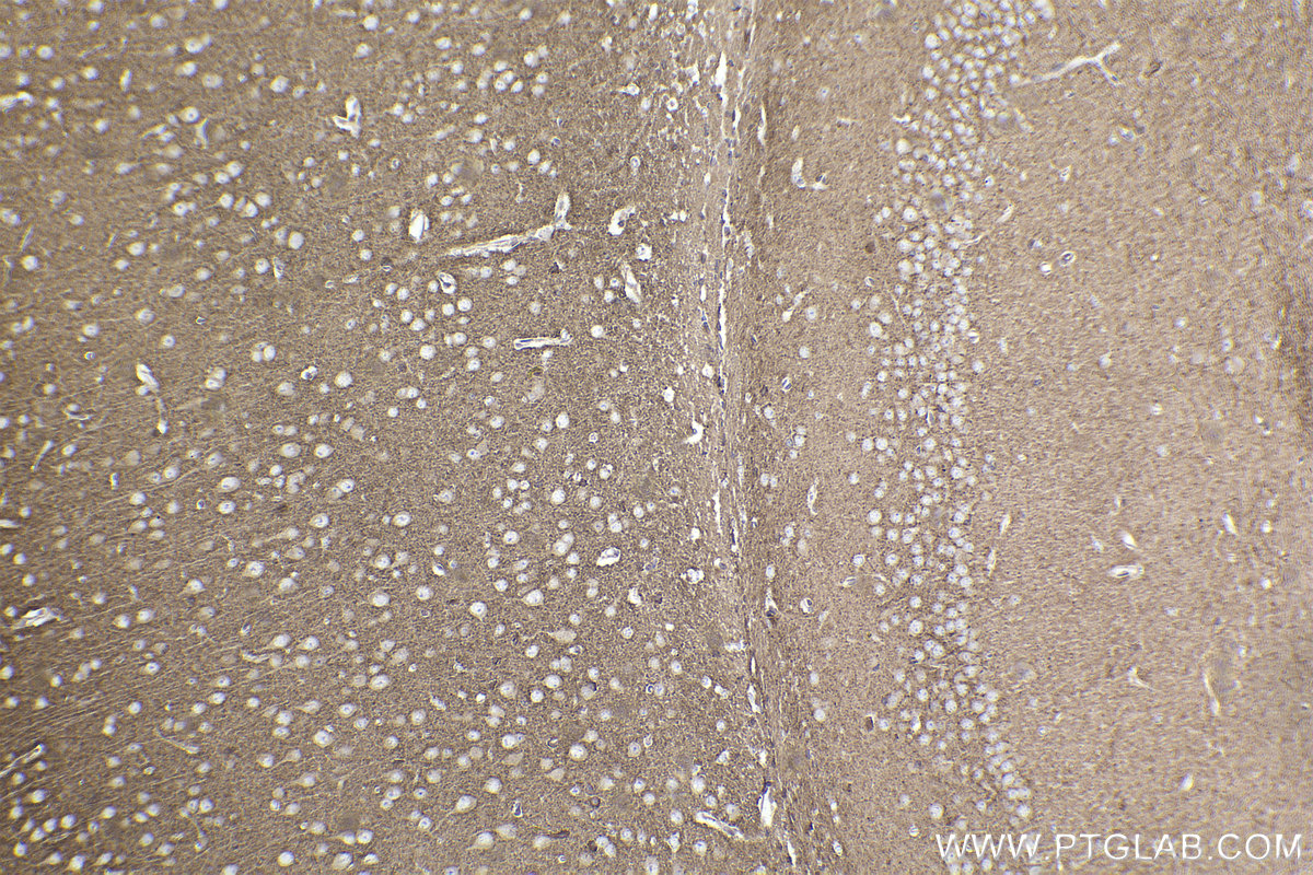 Immunohistochemical analysis of paraffin-embedded mouse brain tissue slide using KHC2202 (RAB3B/C IHC Kit).