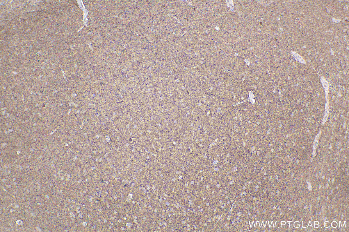 Immunohistochemical analysis of paraffin-embedded rat brain tissue slide using KHC2202 (RAB3B/C IHC Kit).