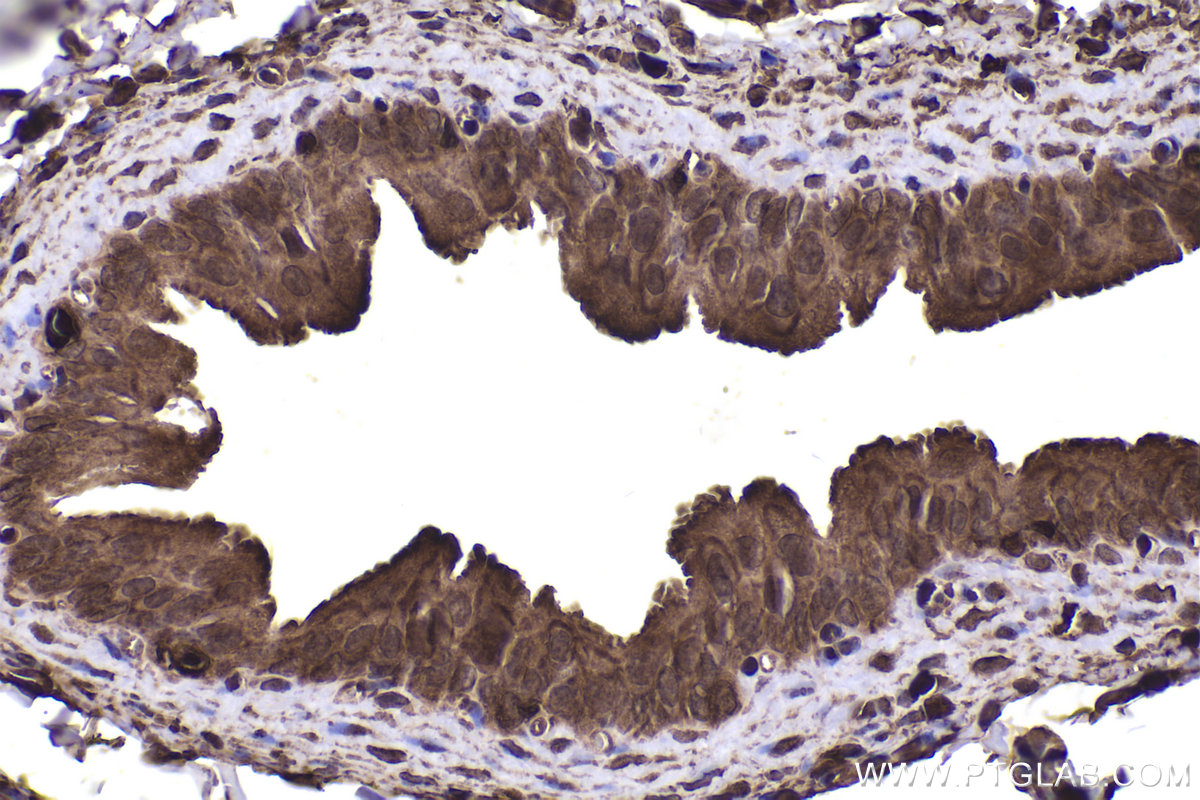 Immunohistochemical analysis of paraffin-embedded rat bladder tissue slide using KHC2356 (RAC1 IHC Kit).