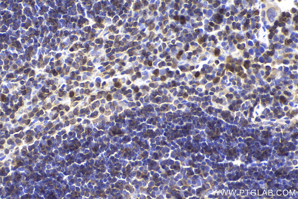 Immunohistochemical analysis of paraffin-embedded mouse spleen tissue slide using KHC2189 (RAC2 IHC Kit).