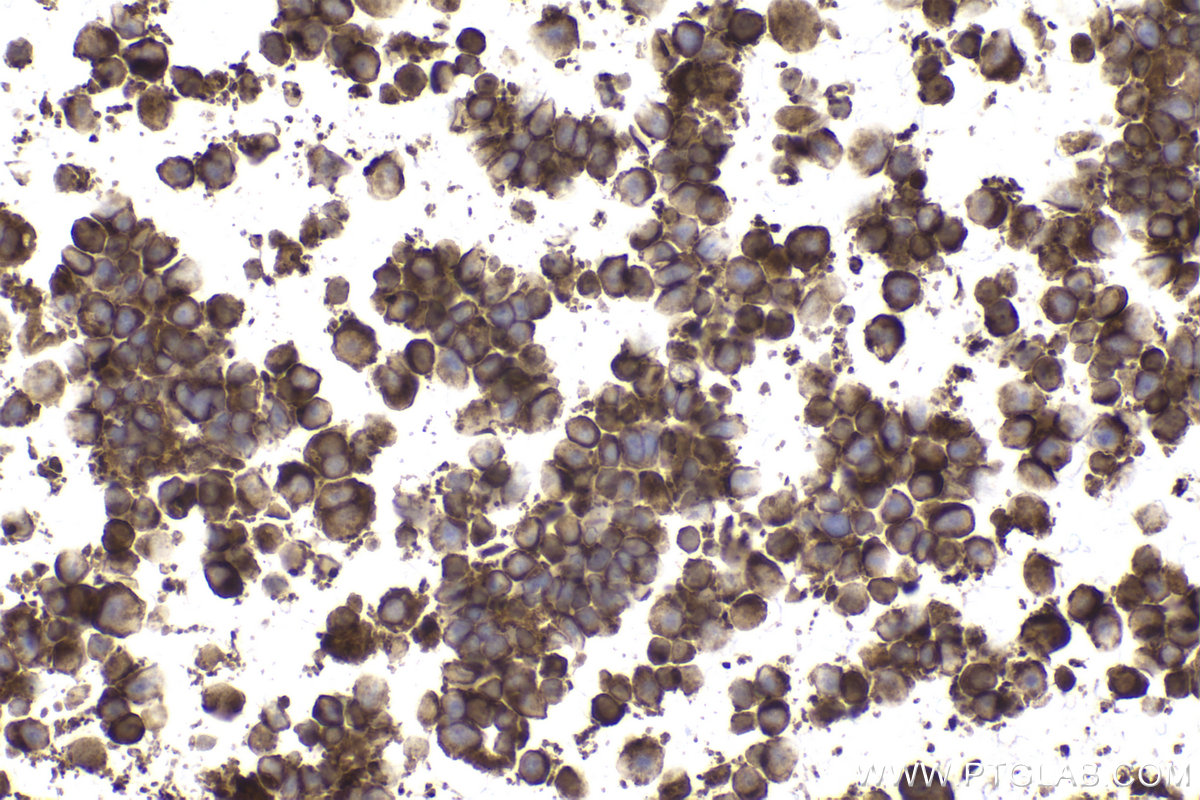 Immunohistochemical analysis of paraffin-embedded MJ cells slide using KHC2189 (RAC2 IHC Kit).