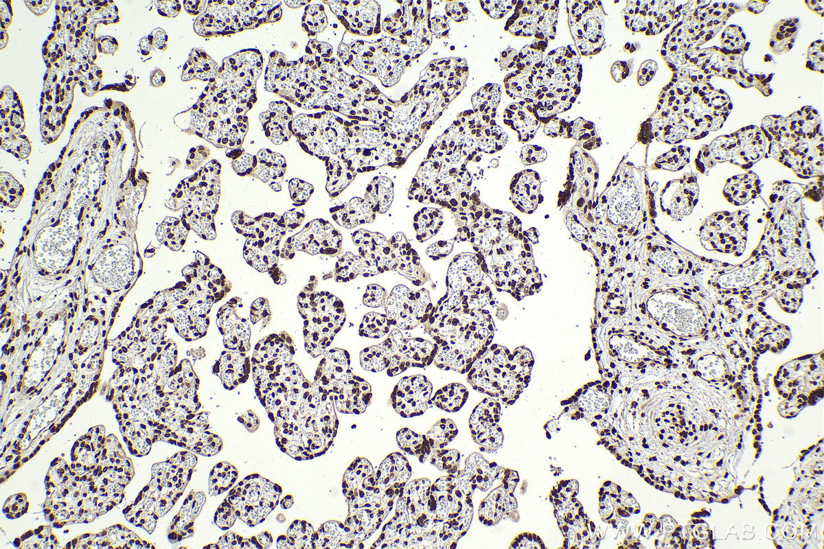 Immunohistochemical analysis of paraffin-embedded human placenta tissue slide using KHC2094 (RAD21 IHC Kit).