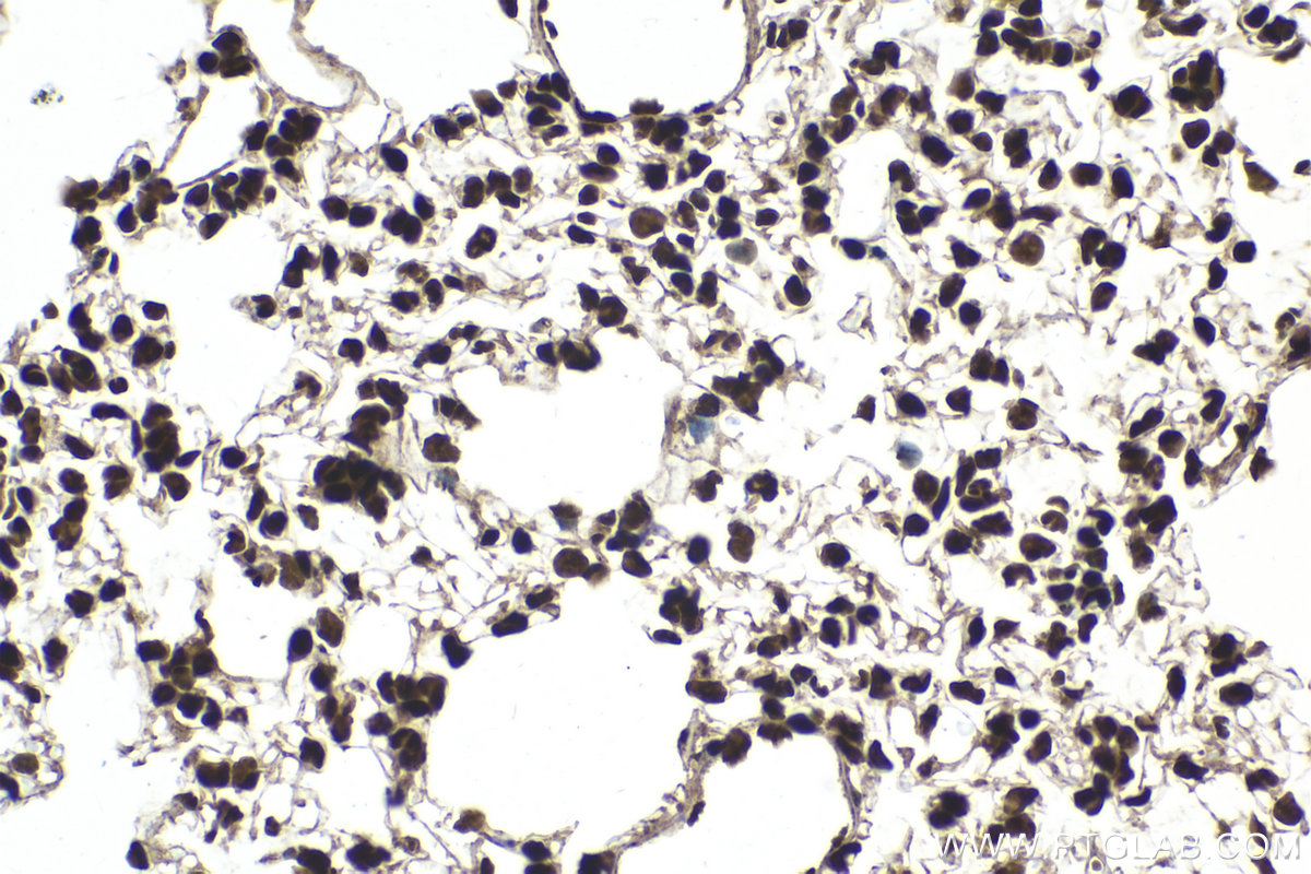 Immunohistochemical analysis of paraffin-embedded mouse lung tissue slide using KHC2094 (RAD21 IHC Kit).