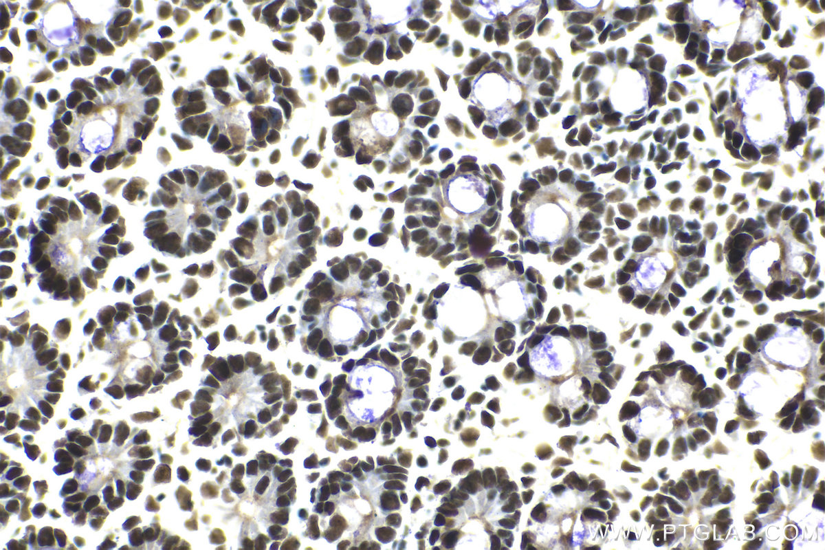 Immunohistochemical analysis of paraffin-embedded mouse small intestine tissue slide using KHC2094 (RAD21 IHC Kit).