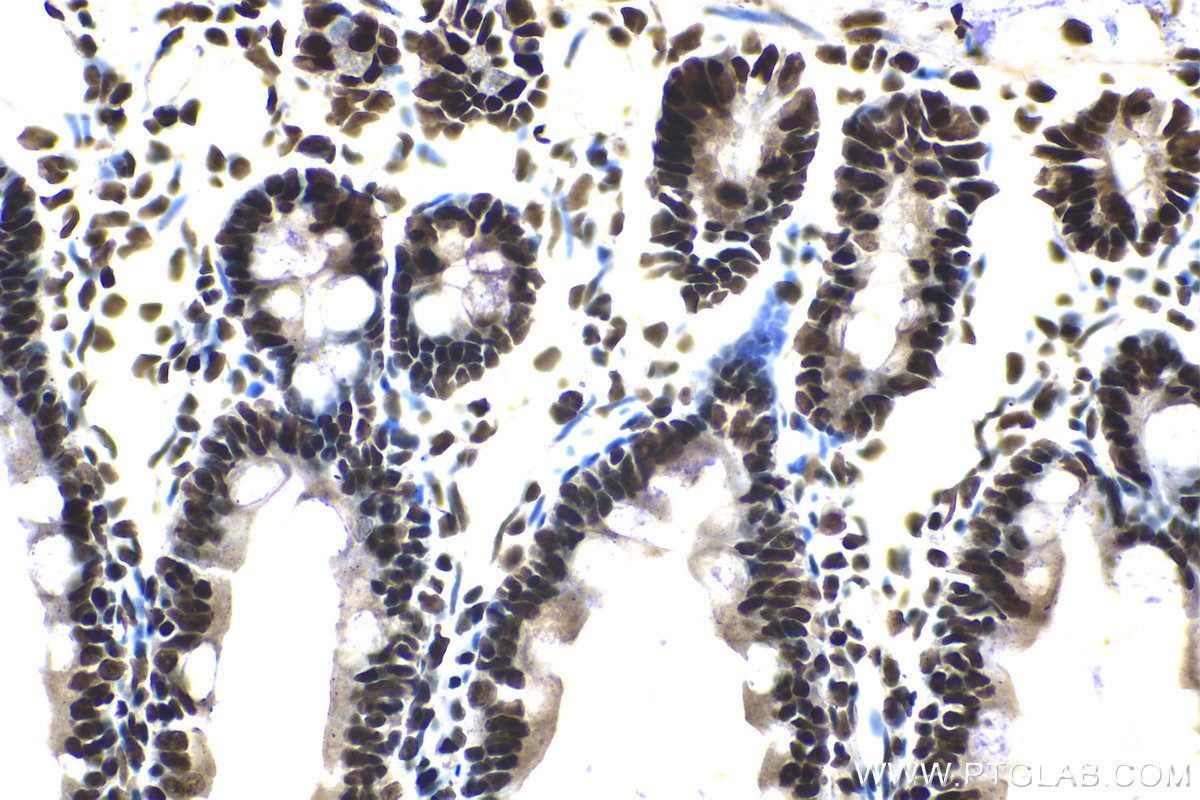 Immunohistochemical analysis of paraffin-embedded rat small intestine tissue slide using KHC2094 (RAD21 IHC Kit).