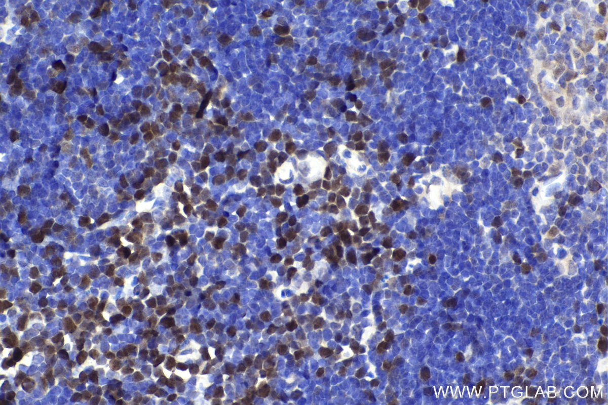 Immunohistochemical analysis of paraffin-embedded mouse thymus tissue slide using KHC2396 (RAD51 IHC Kit).