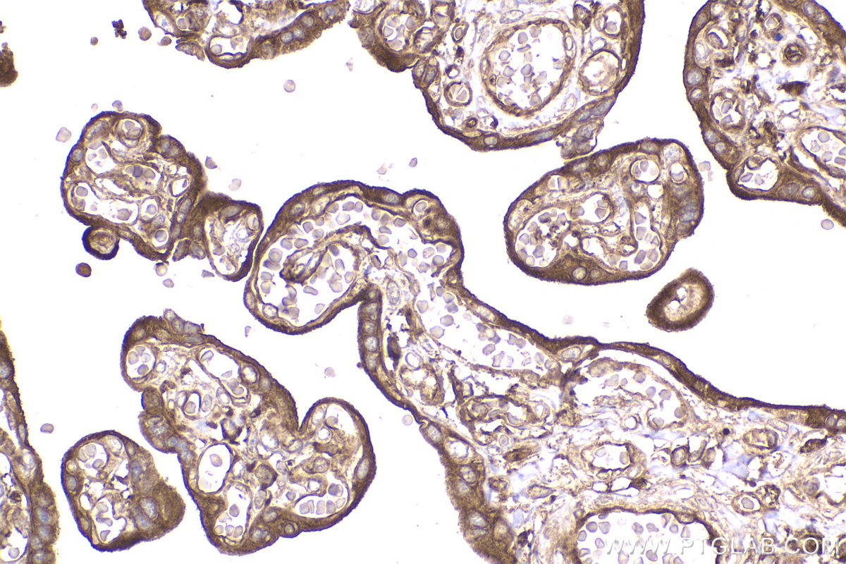 Immunohistochemical analysis of paraffin-embedded human placenta tissue slide using KHC2180 (RALA IHC Kit).