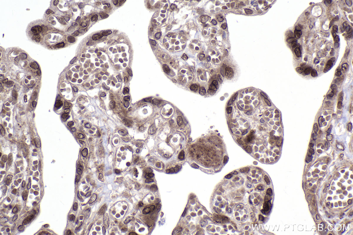 Immunohistochemical analysis of paraffin-embedded human placenta tissue slide using KHC2353 (RAN IHC Kit).