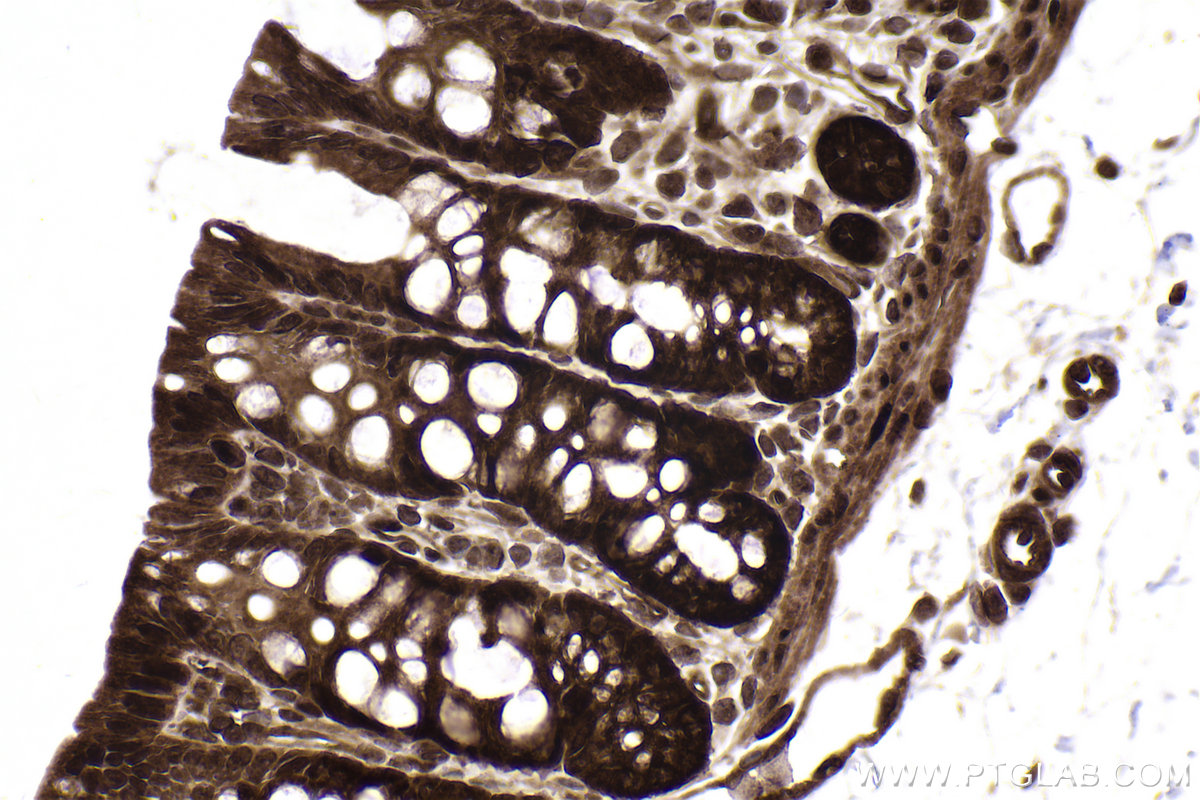 Immunohistochemical analysis of paraffin-embedded rat colon tissue slide using KHC2353 (RAN IHC Kit).