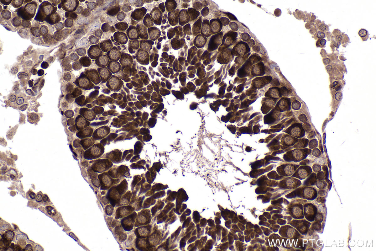 Immunohistochemical analysis of paraffin-embedded rat testis tissue slide using KHC2353 (RAN IHC Kit).