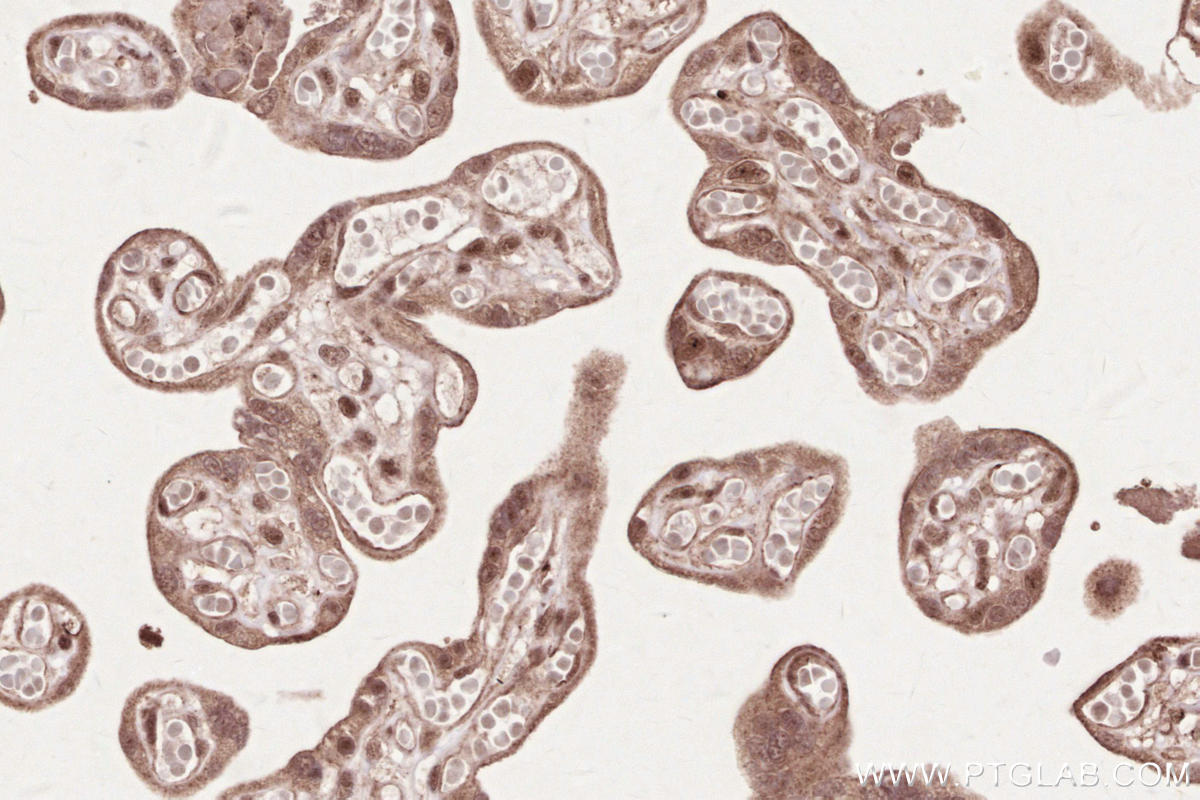 Immunohistochemical analysis of paraffin-embedded human placenta tissue slide using KHC2624 (RBBP6 IHC Kit).