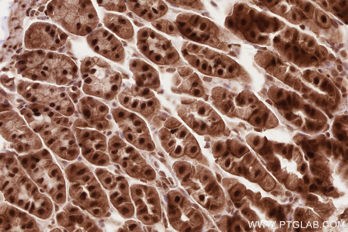 Immunohistochemical analysis of paraffin-embedded mouse stomach tissue slide using KHC2624 (RBBP6 IHC Kit).