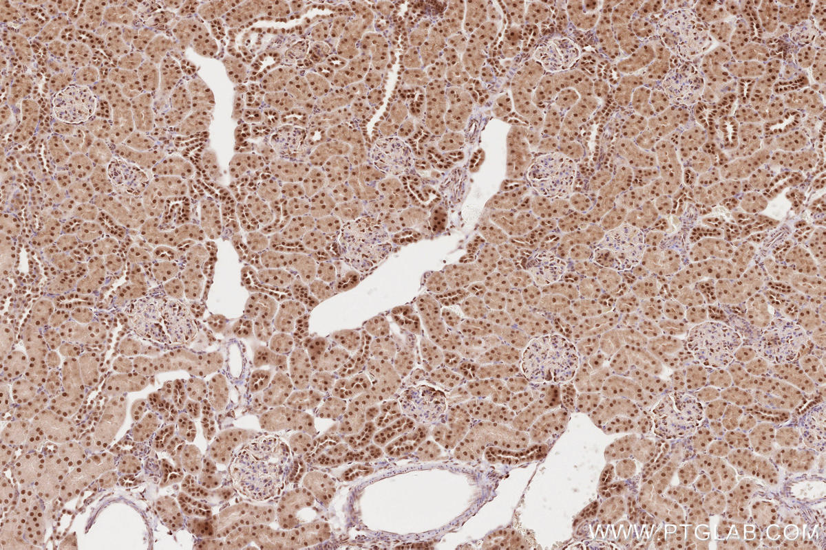 Immunohistochemical analysis of paraffin-embedded rat kidney tissue slide using KHC2624 (RBBP6 IHC Kit).