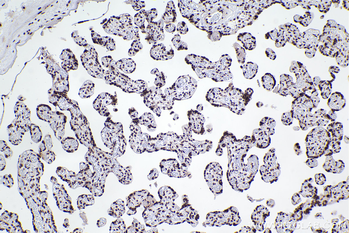 Immunohistochemical analysis of paraffin-embedded human placenta tissue slide using KHC2504 (RBBP7 IHC Kit).