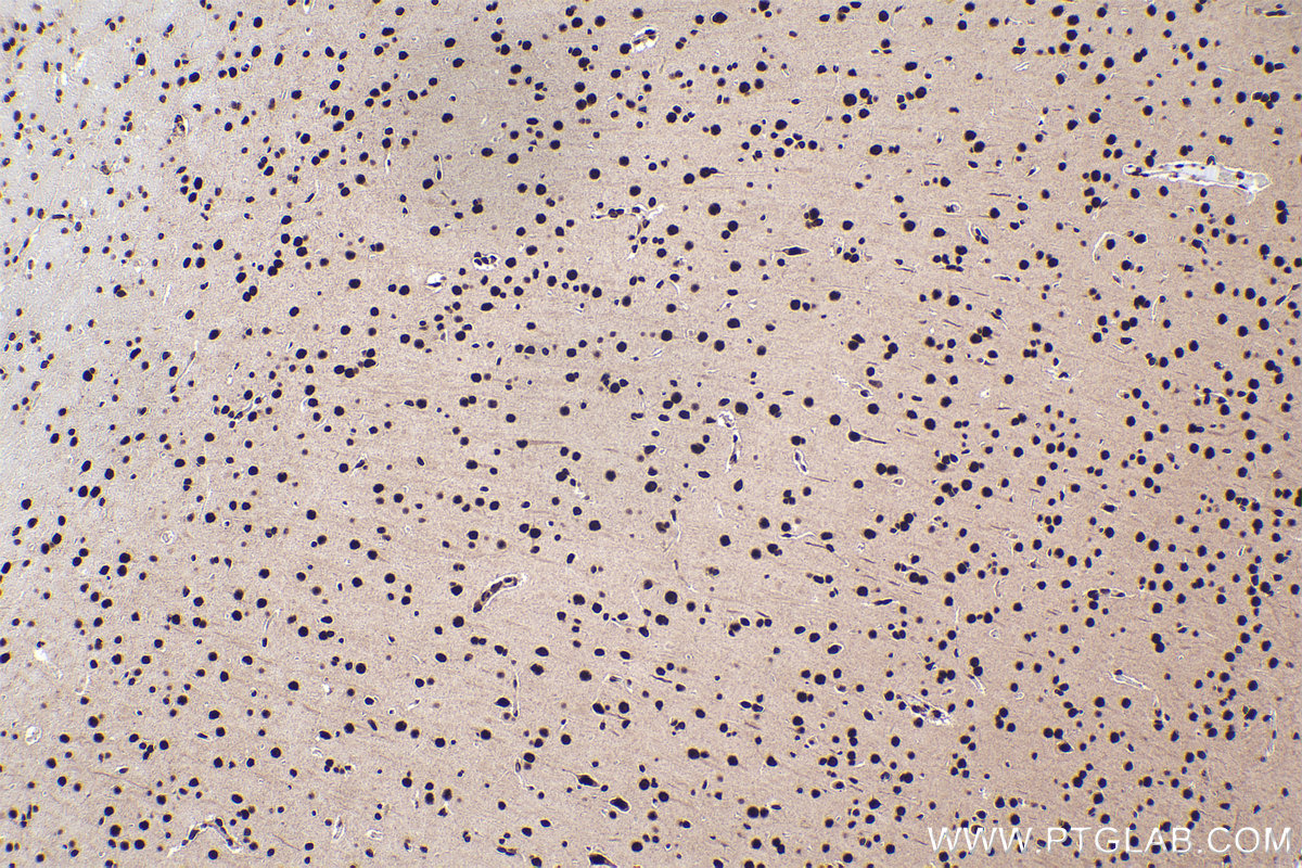 Immunohistochemical analysis of paraffin-embedded rat brain tissue slide using KHC2504 (RBBP7 IHC Kit).