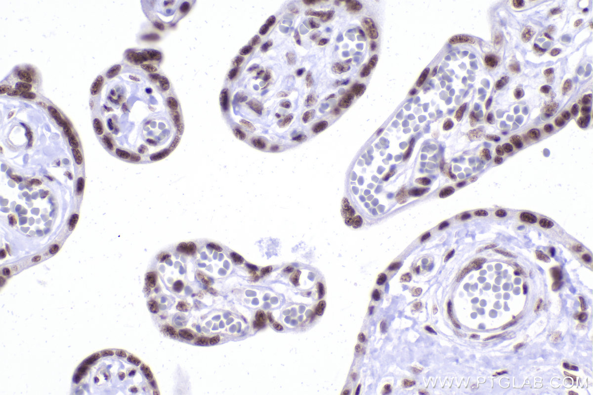 Immunohistochemical analysis of paraffin-embedded human placenta tissue slide using KHC2378 (RBM10 IHC Kit).