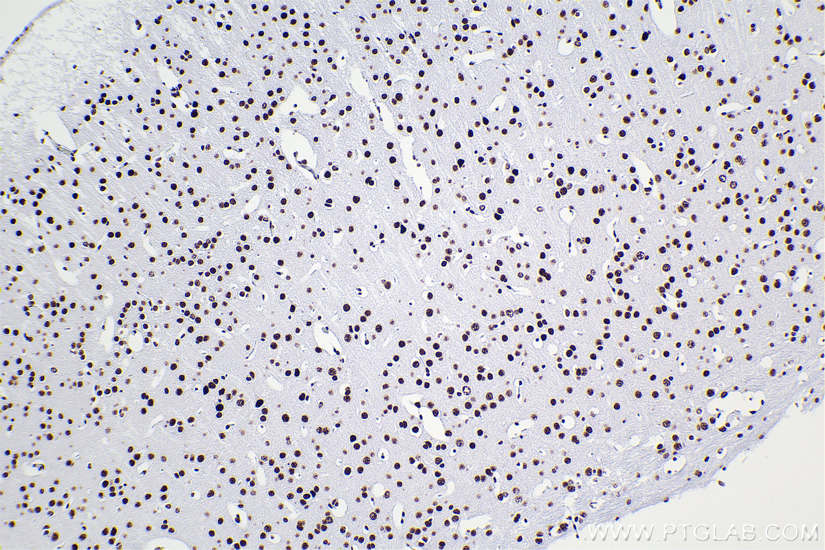 Immunohistochemical analysis of paraffin-embedded mouse brain tissue slide using KHC2378 (RBM10 IHC Kit).