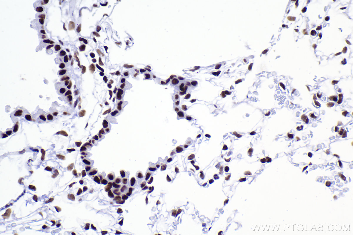 Immunohistochemical analysis of paraffin-embedded mouse lung tissue slide using KHC2378 (RBM10 IHC Kit).