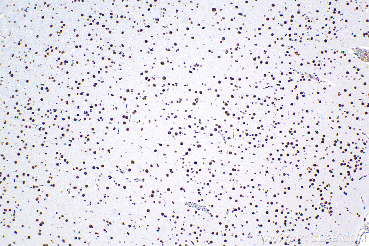 Immunohistochemical analysis of paraffin-embedded rat brain tissue slide using KHC2378 (RBM10 IHC Kit).