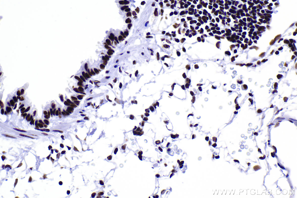 Immunohistochemical analysis of paraffin-embedded rat lung tissue slide using KHC2378 (RBM10 IHC Kit).