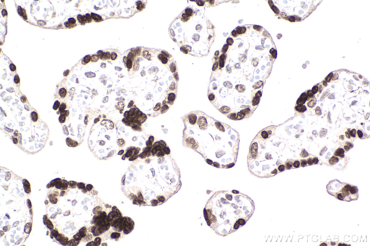 Immunohistochemical analysis of paraffin-embedded human placenta tissue slide using KHC2198 (RCC1 IHC Kit).